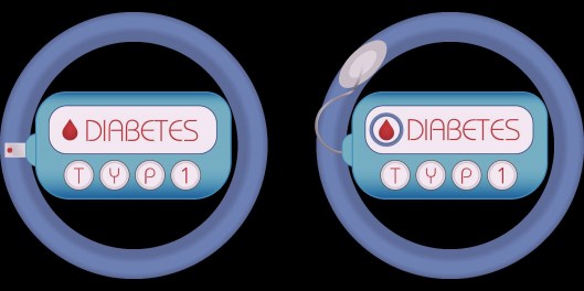 diabetes-e832b00f2a_1920