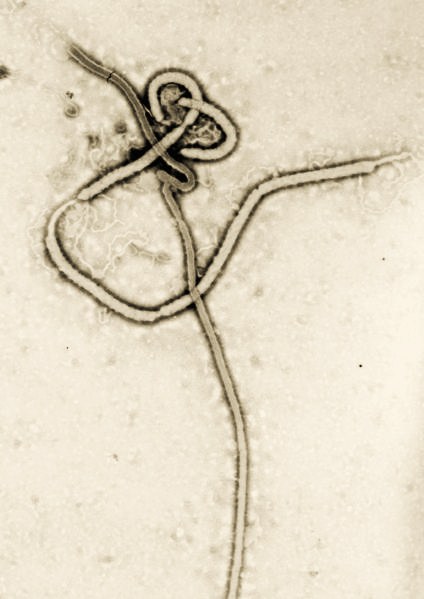 Ebola_virus_em